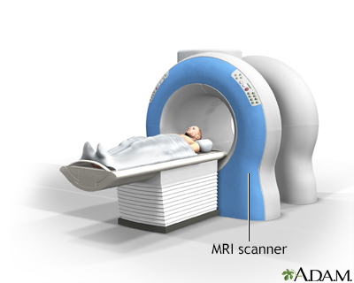 MRI scans