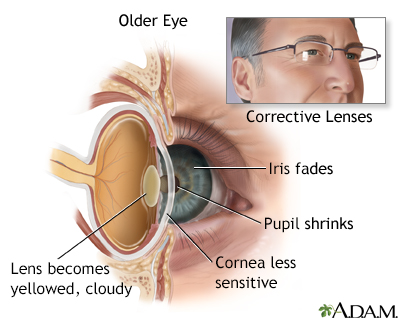 Aged eye anatomy