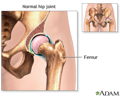 Hip joint replacement - series - Normal anatomy