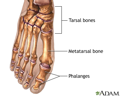 Bunion removal - Series