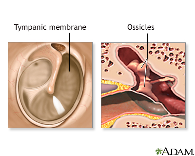 Normal anatomy