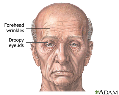 Visible signs of aging - Indication