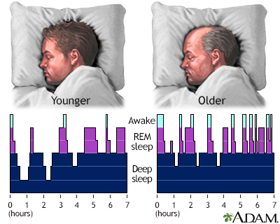 Sleep patterns in the young and aged