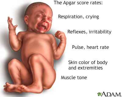 Apgar Scores