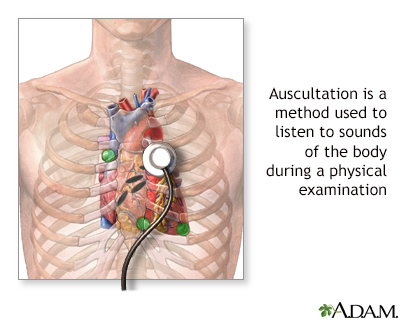 Auscultation