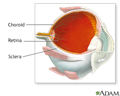 Choroid of the eye