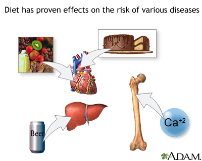 Diet and disease prevention