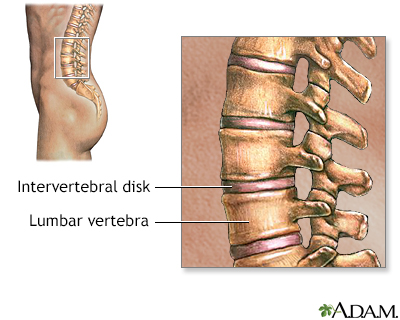 Lumbar vertebrae