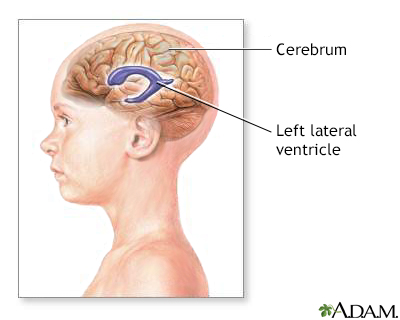 Ventricles of the brain