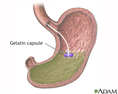 Gelatin capsule in stomach