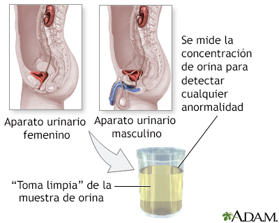 Prueba de concentración de orina