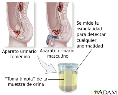 Prueba de osmolalidad