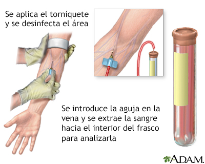 Examen de sangre