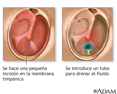 Procedimiento