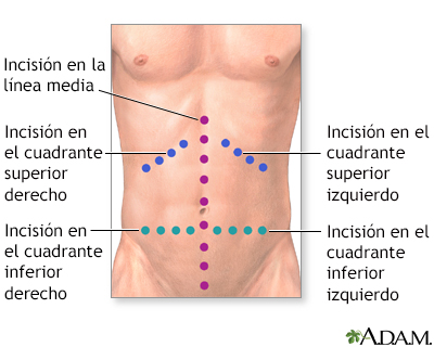 Procedimiento