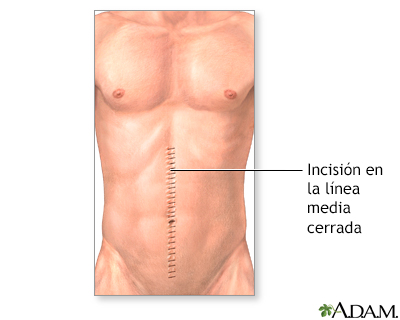 Cuidados postoperatorios