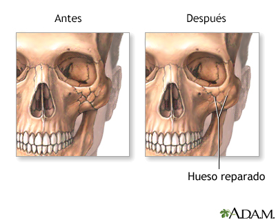 Cuidados postoperatorios