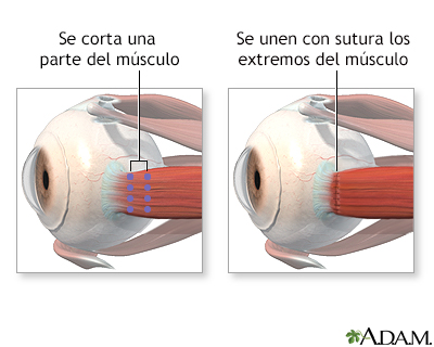 Procedimiento