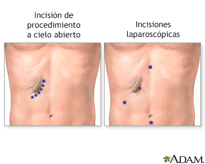 Cuidados postoperatorios