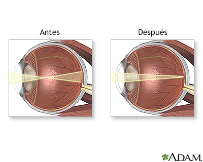 Cuidados postoperatorios