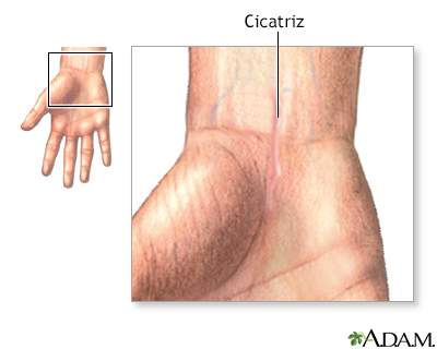 Cuidados postoperatorios