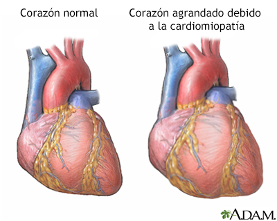 Indicaciones