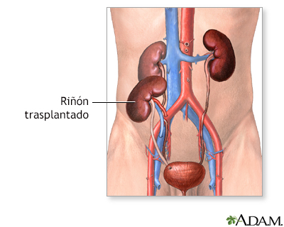 Cuidados postoperatorios