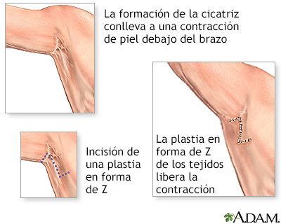 Procedimiento