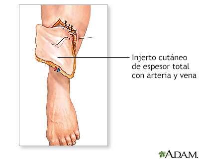 Procedimiento