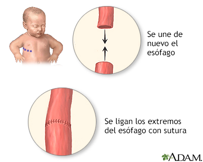 Procedimiento (segunda parte)