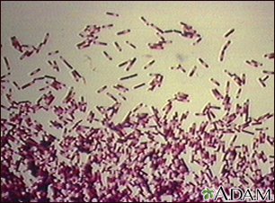 Organismo Clostridioides difficile