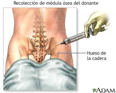 Procedimiento