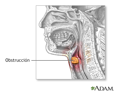 Indicaciones