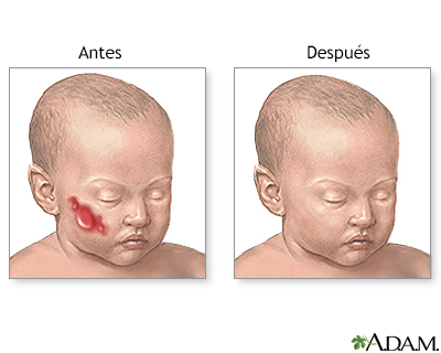 Cuidados postoperatorios