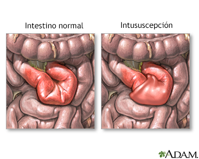 Indicaciones (primera parte)