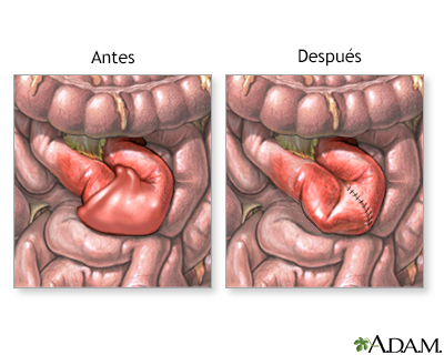 Cuidados postoperatorios