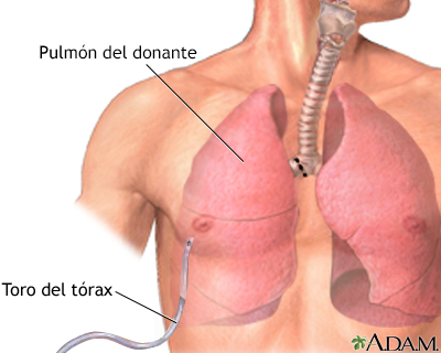 Cuidados postoperatorios