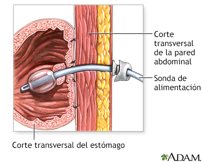 Procedimiento (primera parte)