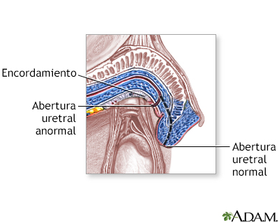 Procedimiento