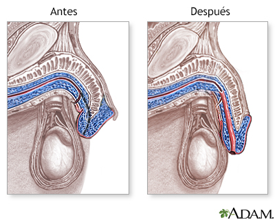 Cuidados postoperatorios