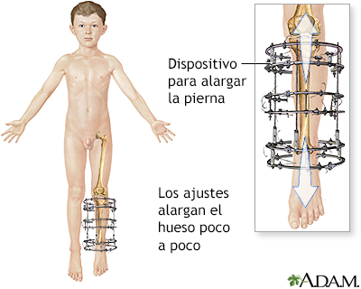 Cuidados postoperatorios