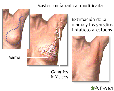 Procedimiento (segunda parte)