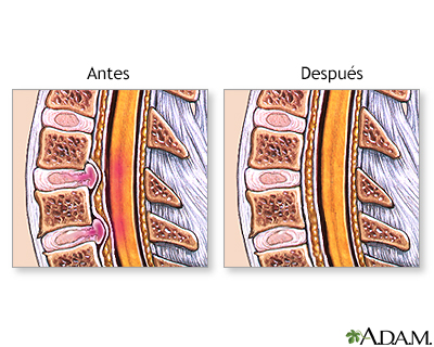 Cuidados postoperatorios