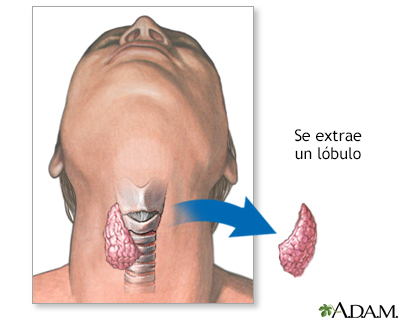 Procedimiento