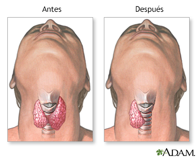 Cuidados postoperatorios