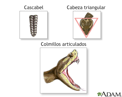 Características