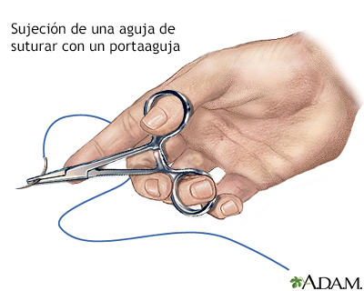 Cómo cerrar una herida por sutura (primera parte)
