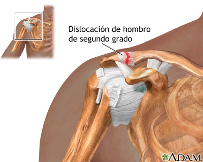 Indicaciones (primera parte)