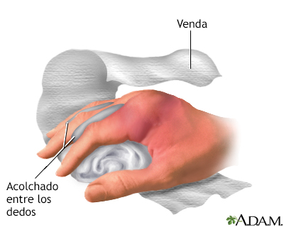 Indicaciones (primera parte)