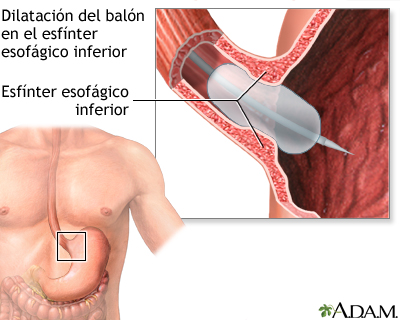 Procedimiento, parte 1